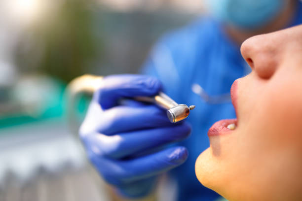 Best Veneers and Lumineers  in Staffd, OR